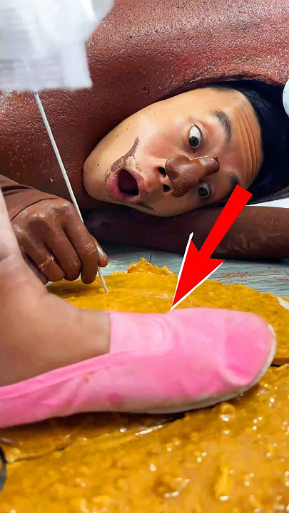 ToRung comedy: 😂 lost the squid game 🦑