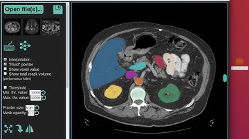 Quick demo of interactive AI segmentation in the web-browser