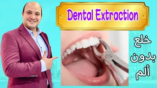 خلع الضرس | Dental Extraction
