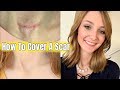 How To Cover A Scar or Surgical Incision!