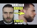 COMO ARREGLAR BARBA en CASA | CAMBIO RADICAL después de MESES