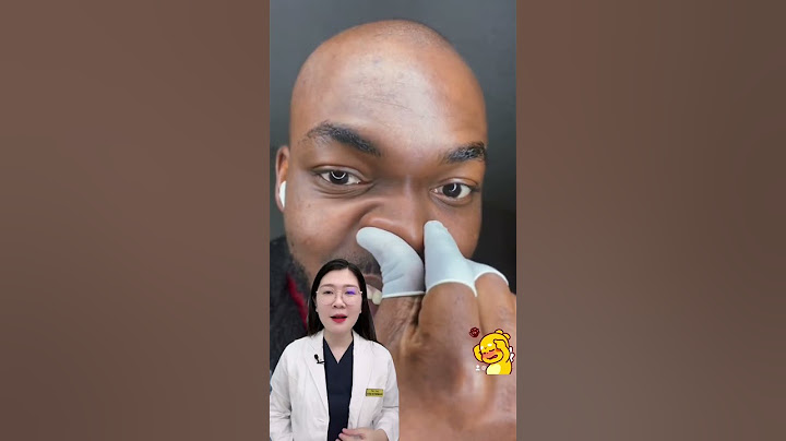 Review - Cách ngừa Sợi bã nhờn, mụn đầu đen ở mũi #thsbsphuongquy #review #reaction #shorts