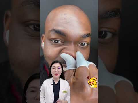 Video: 4 cách để loại bỏ vết mồ hôi trên trang tính