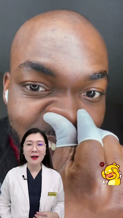 Review - Cách ngừa Sợi bã nhờn, mụn đầu đen ở mũi #thsbsphuongquy #review #reaction #shorts