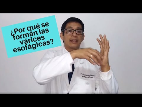 Video: ¿A quién afectan las várices esofágicas?