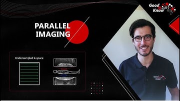 Good to Know - Parallel Imaging SPEEDER and Exsper
