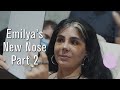 Emilya's New Nose Part 2 - Rhinoplasty in Vanity Cosmetic Surgery Hospital #rhinoplasty #istanbul