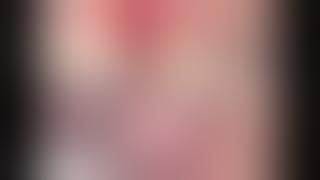 Laschal Surgical - Niemczyk Micro-Suture Set