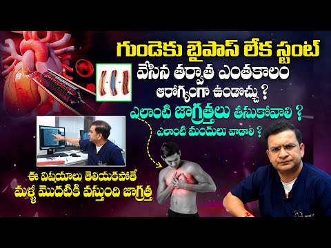 చాలా అరుదైన వీడియో మీకోసం - Unknown Facts About Heart Stent and Bypass || Dr Movva Srinivas || THF