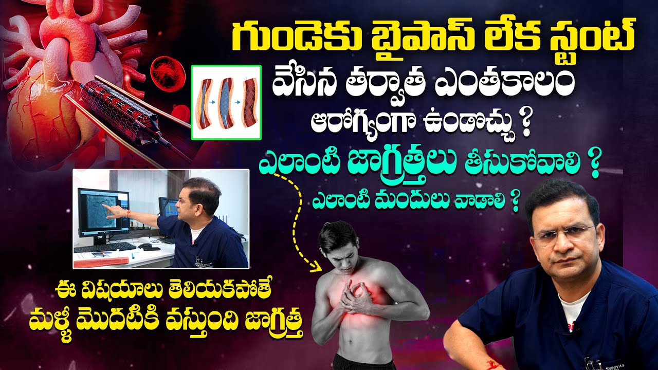 చాలా అరుదైన వీడియో మీకోసం - Unknown Facts About Heart Stent and Bypass || Dr Movva Srinivas || THF