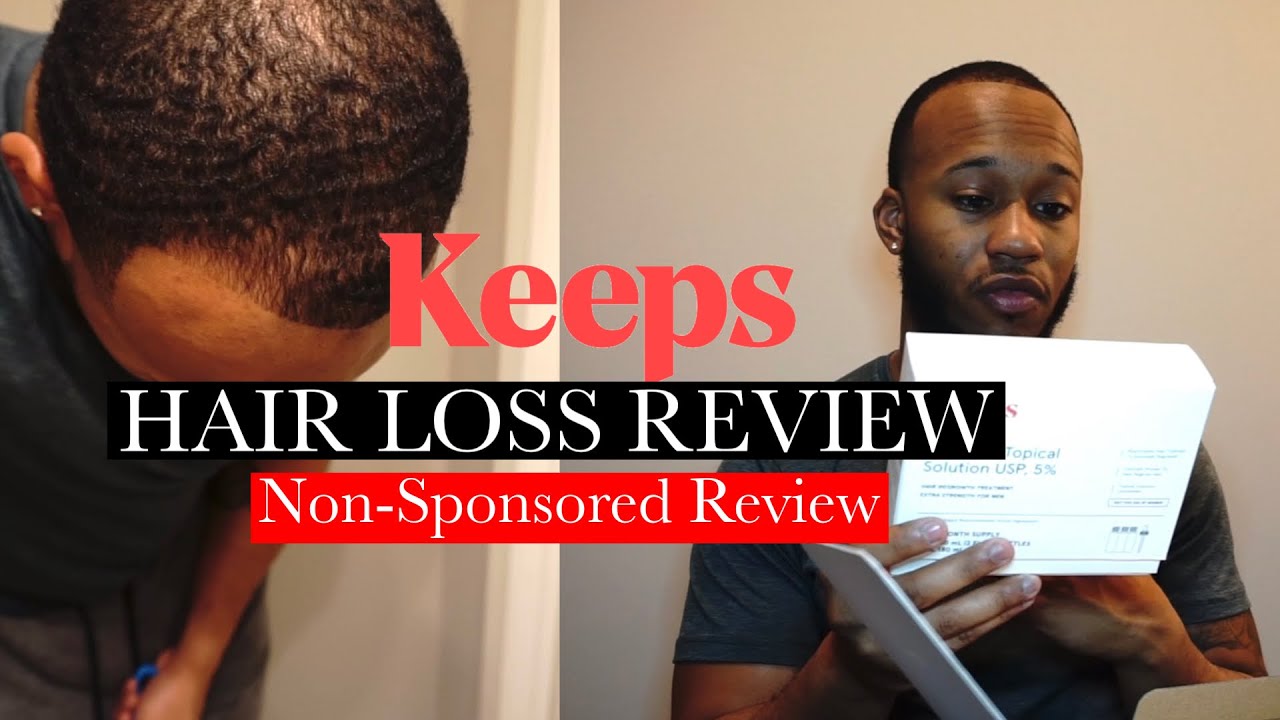 KEEPS Hair Loss Review - Non Sponsored Review!