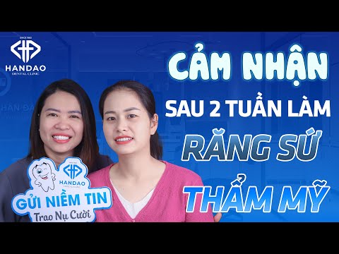 Răng thưa khắc phục như thế nào? Cảm nhận sau 2 tuần làm răng sứ – Ngọc Ánh