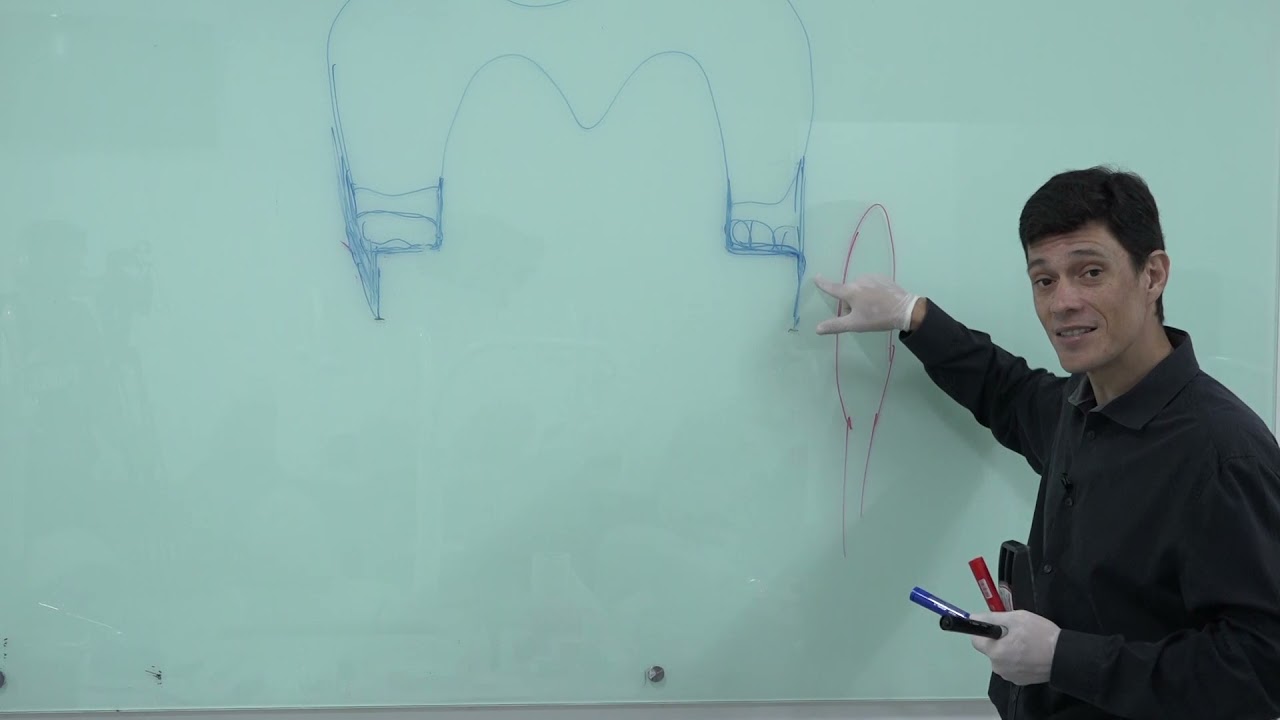 Reembasamento de Provisório.