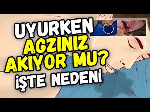 Uyurken ağzınız akıyorsa dikkat! Nedenleri çok tehlikeli...