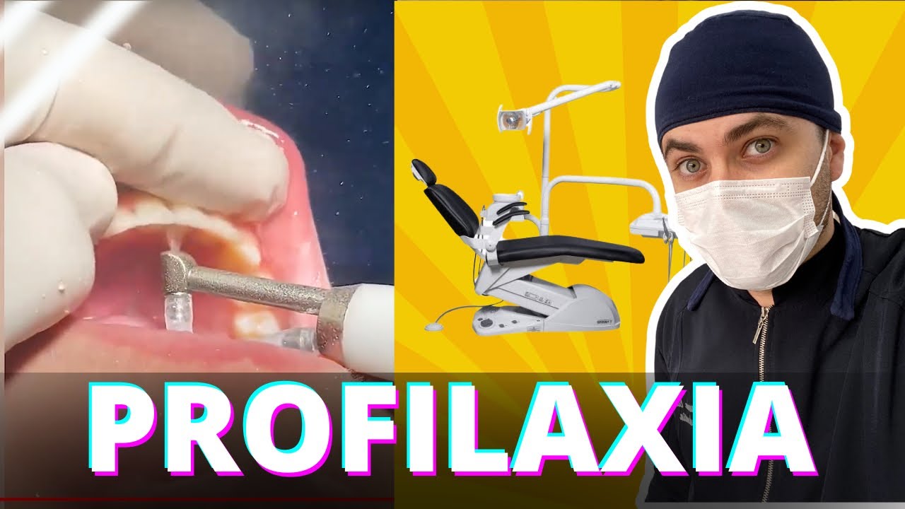 MATERIAIS USADOS NA PROFILAXIA ODONTOLÓGICA - ASB TOTAL