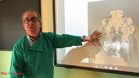 Anteprima mondiale sulla nuova classificazione del...