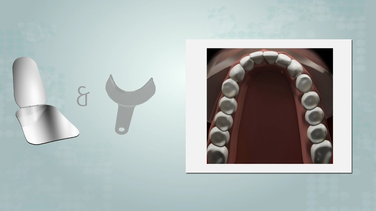 Fotografia Oclusal