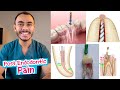 5 اسباب للـ Post Endodontic Pain