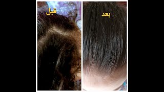 حل سحري وسهل جدا للقضاء علي هيشان الشعر عند الأطفال والكبار كمان
