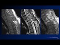 Neuroradiology board review 2 case 10