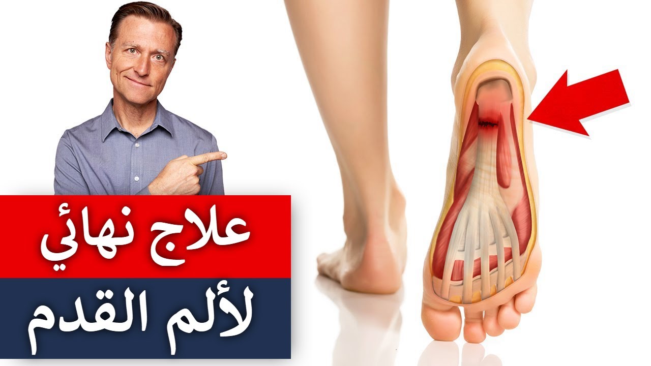 كيف تتخلص من ألم الكعب وأسفل القدم فورًا | التهاب اللفافة الأخمصية