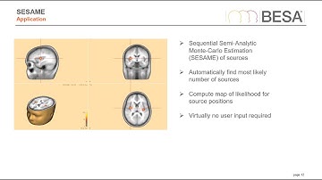Webinar: What is Bayesian M/EEG Source Analysis, and why should I care