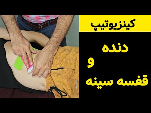 کینزیوتیپ برای فیکس کردن دنده و کم شدن درد قفسه سینه پس از ضربه و آسیب به دنده ها