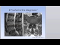 Differential Diagnosis II (Lumbar Spine Disease) Summer-2015-Edited Version