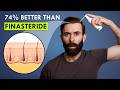 New Spray Grows New Hair in 3 Months (74% Better Than Finasteride)