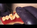 Мастер-класс по восстановлению жевательного зуба