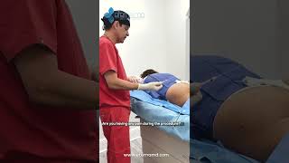 Sculptra To The Glutes | Dr. Mercado | Eterna MD | Orlando, FL