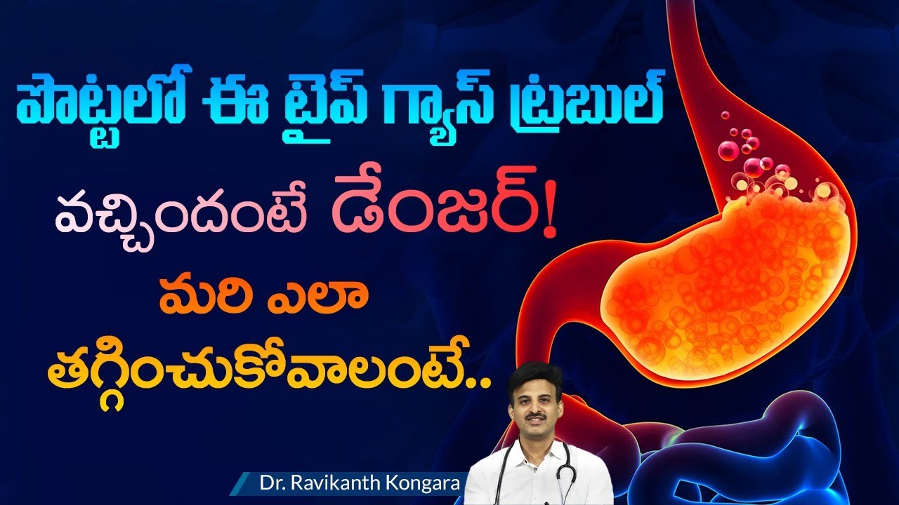 How to Get Rid of Gas Trouble | Hiatus Hernia | Acid Reflux | Relief from GERD |Dr.Ravikanth Kongara