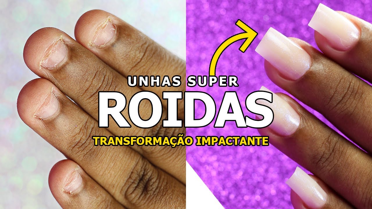 FIBRA DE VIDRO EM UNHAS ROÍDAS (IMPRESSIONANTE) FIBRA DE VIDRO EM UNHAS ROÍDAS (IMPRESSIONANTE)