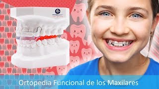 Ortopedia Funcional de los Maxilares