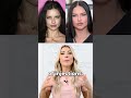 What cosmetic procedures has adriana lima had done 