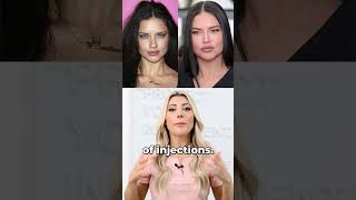 What cosmetic procedures has Adriana Lima had done? 💉