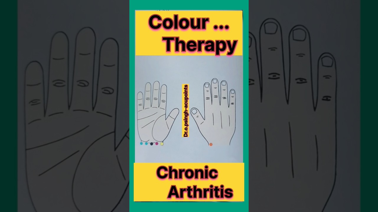 Chronic arthritis: जीर्ण गठिया का पाक इलाज़ | acupressure points | colour therapy 