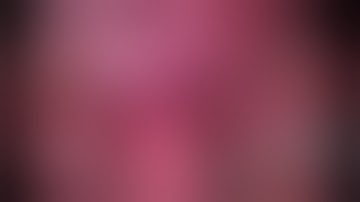 Difficult Calots Dissection in Laparoscopic Cholecystectomy: Some Useful Tricks for Surgeons