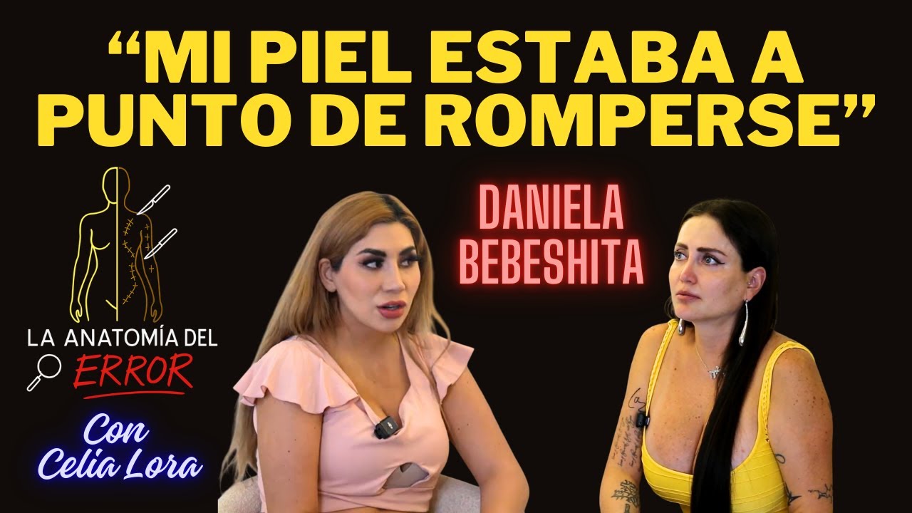 Bebeshita: la MALA CIRUGÍA que le cambió la vida | La ANATOMÍA del ERROR con Celia Lora