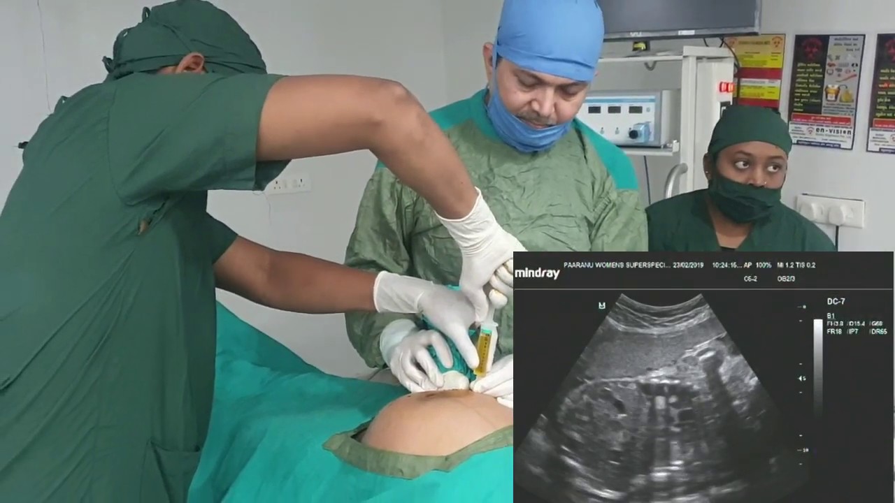 Pleural Effusion Treatment by Dr. Jayesh Patel at Paaranu ...