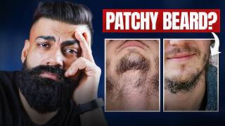 How to fix a patchy beard? Perfect Solution for Beard Growth REVEALED | Beard Growth Formula