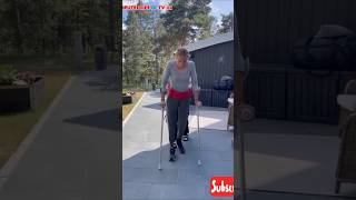 Beautiful amputee learning crutching | recovery  #crutching