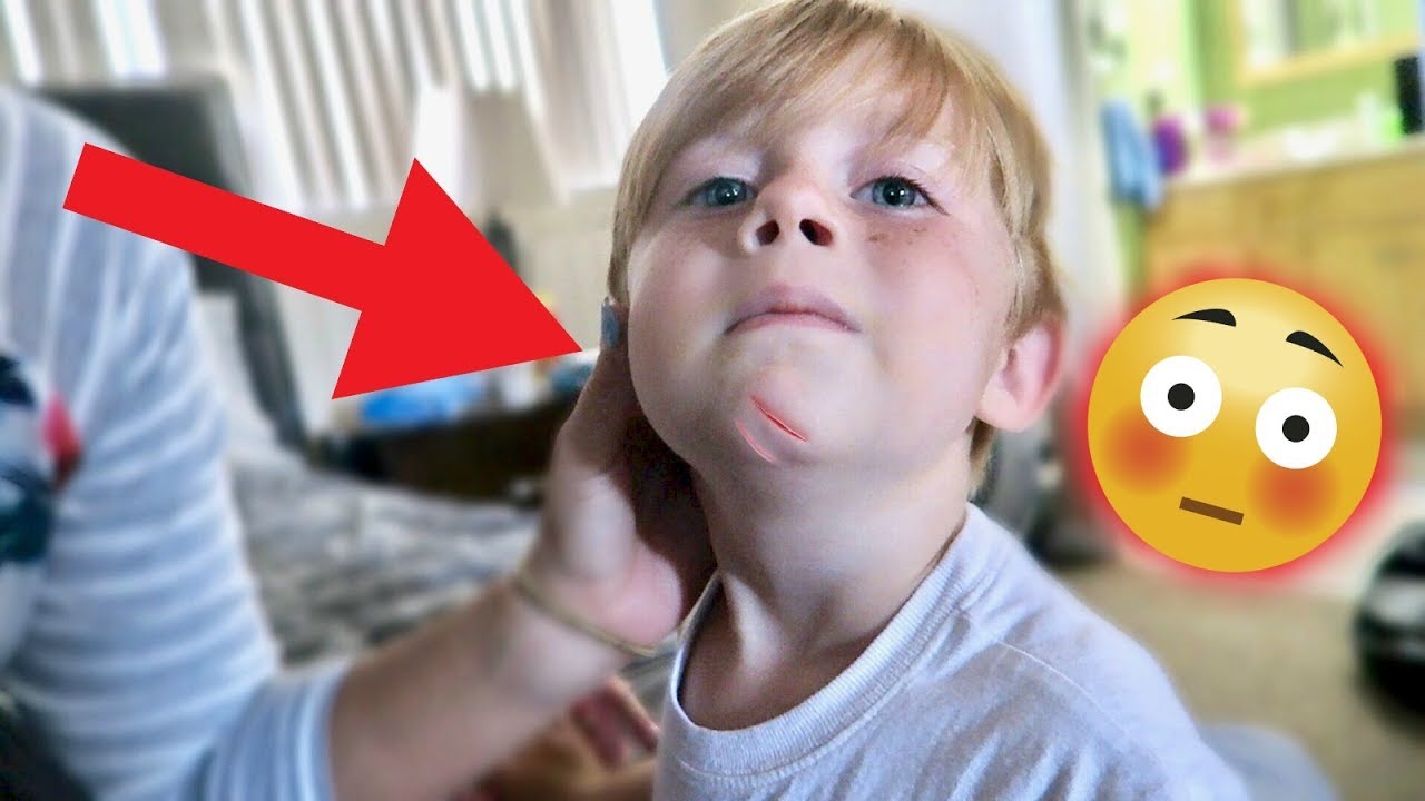 TODDLER FALLS DOWN STAIRS!!