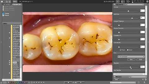 Nikon View NX2 tutorial for dental photography editing