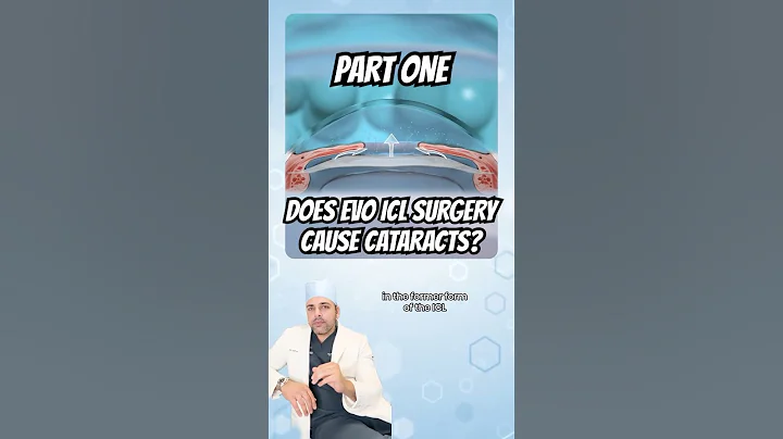 Does EVO ICL Surgery Cause Cataracts? | Part 1