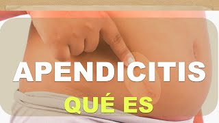 Apendicitis: Qué es y cómo se produce
