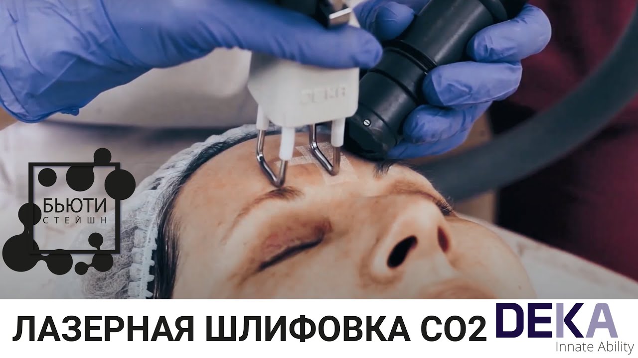 Лазерная шлифовка CO2 с ДЕКА