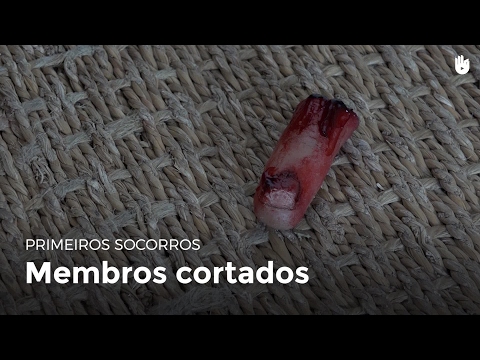 Vídeo: Dedo Cortado: Primeiros Socorros, Cirurgia E Recuperação