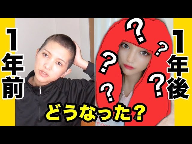 坊主から１年記念日 髪の毛どうなった Youtube