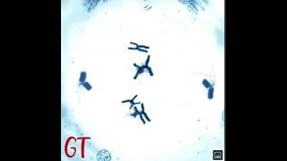SPINDLE FIBRE FORMATION AND DIVISION OF CHROMOSOME